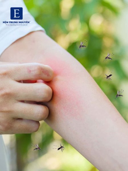 Muỗi và côn trùng sinh sôi mạnh hơn vào mùa mưa