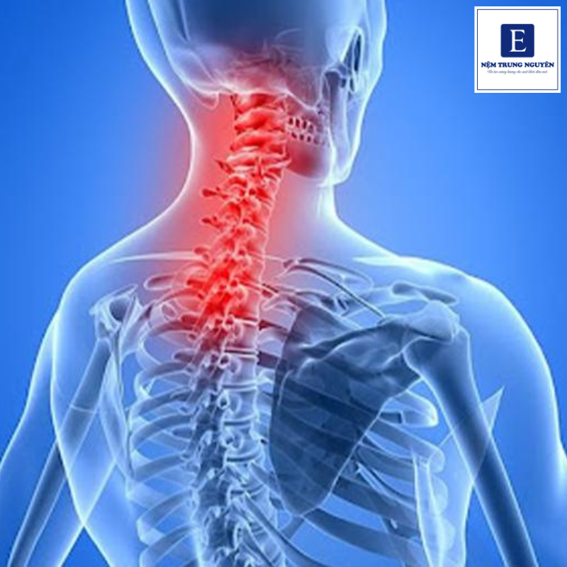 Thoái hóa đốt sống cổ ảnh hưởng rất lớn đến giấc ngủ