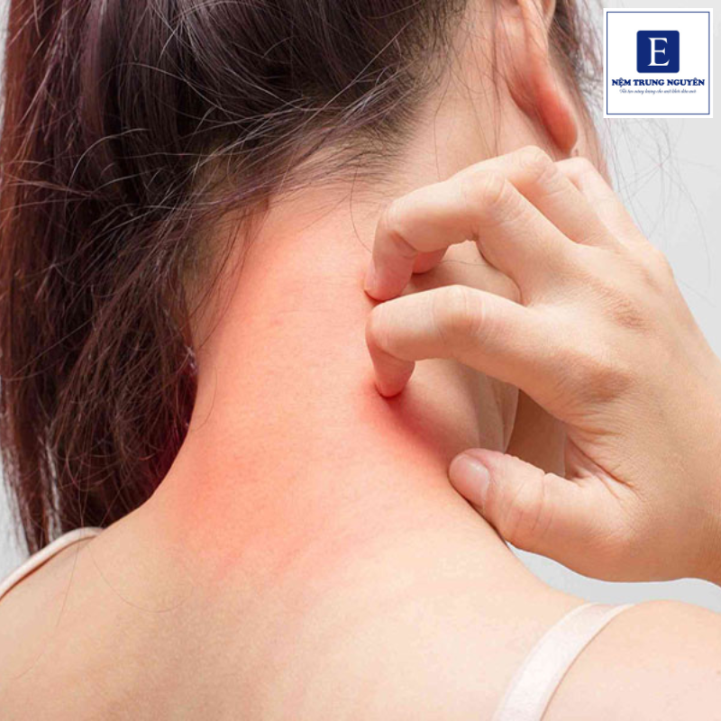 Tình trạng ngứa kéo dài trong thời gian dài, nó có thể gây ra một số vấn đề như mất ngủ, viêm da hoặc dị ứng da